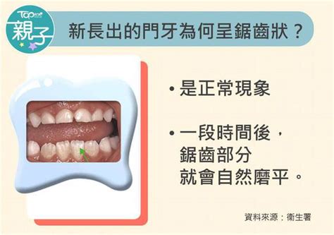 2歲出大牙|【兒童換牙】小朋友幾歲出牙換牙？ 一文看清兒童換。